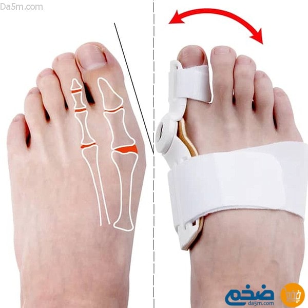 Toe correction splint